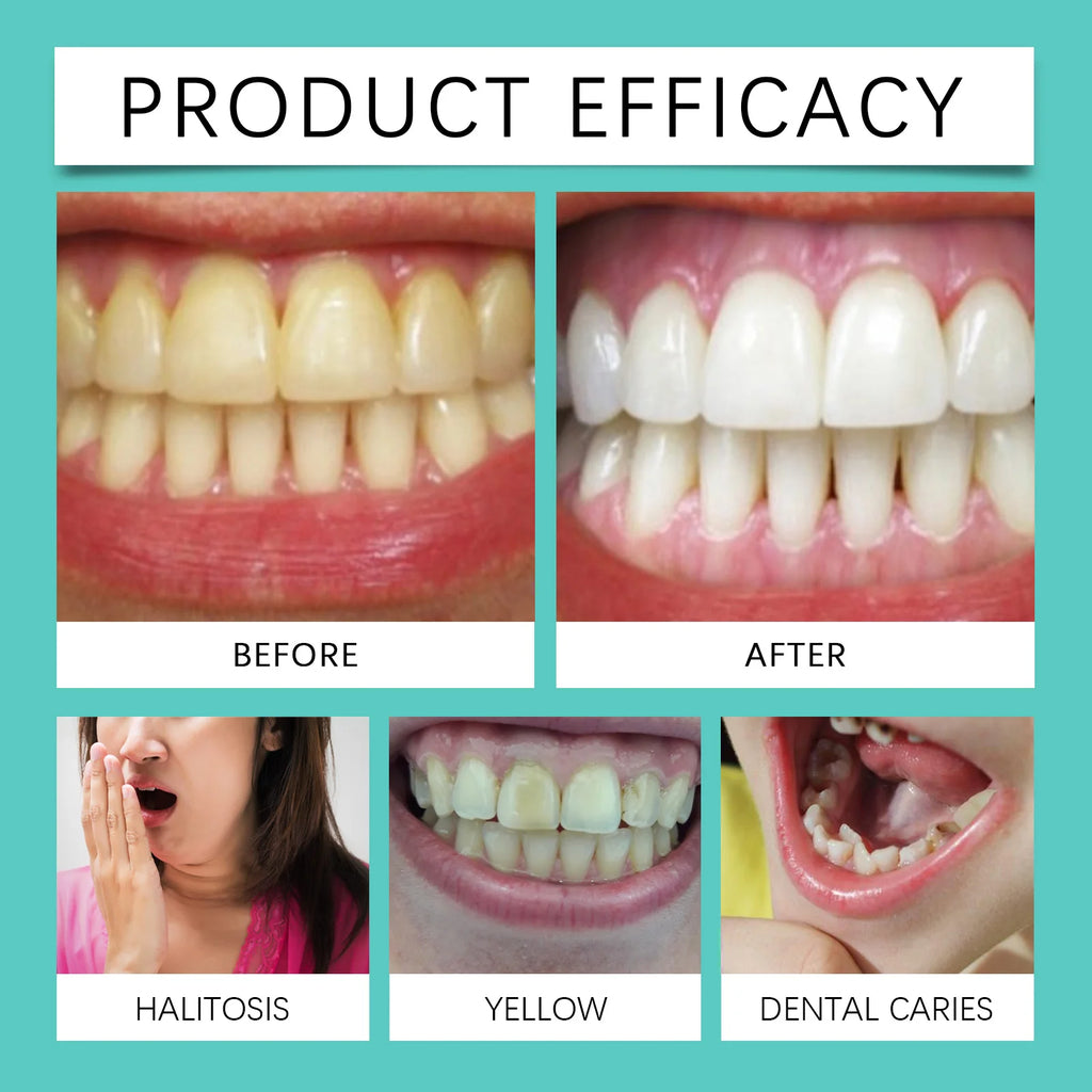 Advanced Teeth Whitening Strips